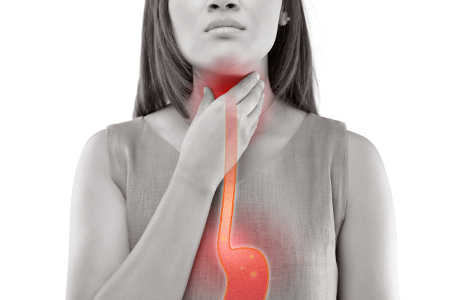 Reflux álarcos