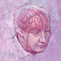 Alzheimer-kór Alzheimer-kór