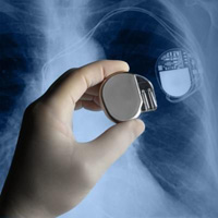 defibrillátor defibrillátor