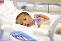 koraszülött, agyvérzés koraszülött, agyvérzés