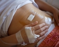 laparoszkópiás vakbélműtét laparoszkópiás vakbélműtét