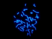 X-kromoszóma
