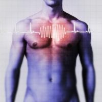 infarktus, szívinfarktus, EKG, mágneses rezonancia