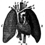 COPD, krónikus obstruktív tüdőbetegség