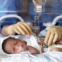 koraszülött baba, terhességi toxikózis, preeclampsia